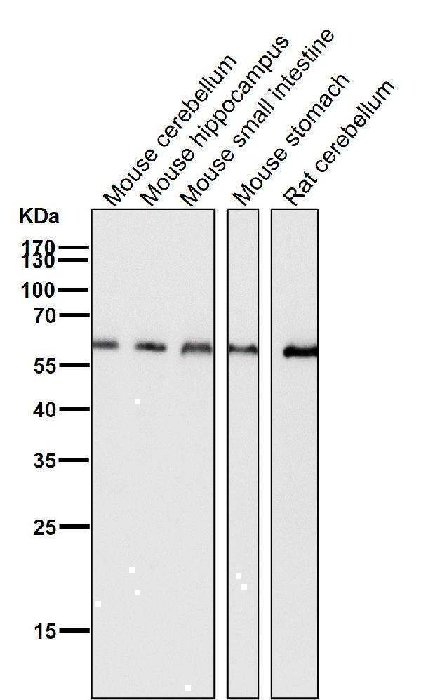All lanes use the Antibody at 1:1K dilution for 1 hour at room temperature