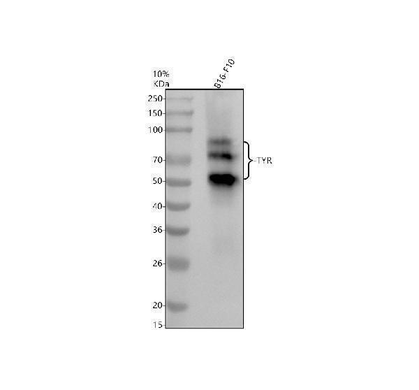 Western blot analysis of TYR using anti-TYR antibody (M00326-1)