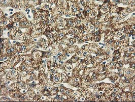 Immunohistochemical staining of paraffin-embedded Human liver tissue within the normal limits using anti-BECN1 mouse monoclonal antibody