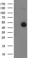 HEK293T cells were transfected with the pCMV6-ENTRY control (Left lane) or pCMV6-ENTRY BECN1 (Right lane) cDNA for 48 hrs and lysed