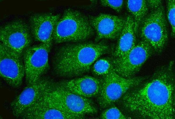 m00327 2 becn1 primary antibodies if testing 6