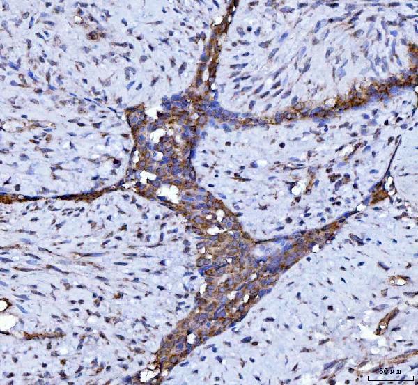  IHC analysis of Beclin 1 using anti-Beclin 1 antibody (M00327-2)