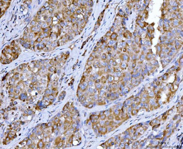  IHC analysis of Beclin 1 using anti-Beclin 1 antibody (M00327-2)