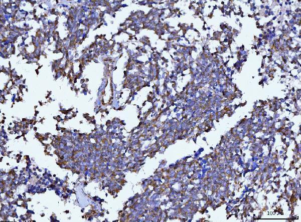 m00327 2 becn1 primary antibodies ihc testing 4