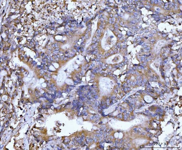 m00327 2 becn1 primary antibodies ihc testing 5