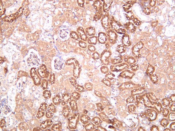 Mouse kidney was stained with anti-Beclin 1 rabbit antibody