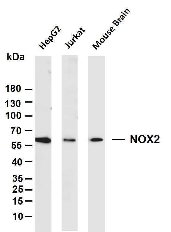 Various whole cell lysates were separated by 4-20% SDS-PAGE, and the membrane was blotted with anti-NOX2 antibody