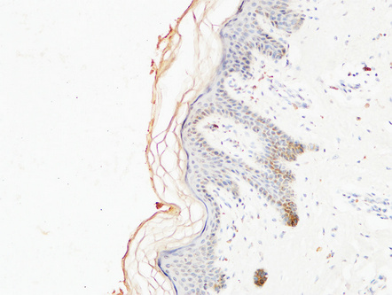 Immunohistochemical analysis of paraffin-embedded Human skin