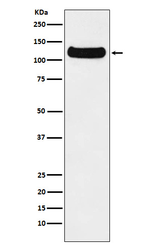 Western blot analysis of DDB1 expression in HeLa cell lysate