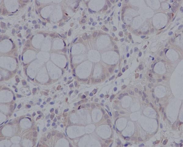 Immunohistochemical analysis of paraffin-embedded human colon, using pro Caspase 3 Antibody