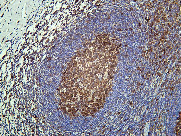 Human tonsil was stained with Anti-Caspase-3 rabbit antibody