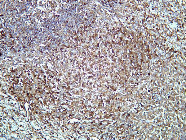 Rat spleen was stained with Anti-Caspase-3 rabbit antibody