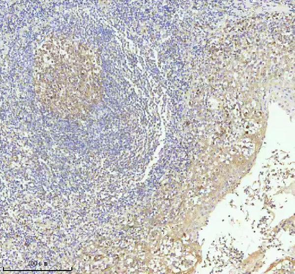  IHC analysis of CASP3 using anti-CASP3 antibody (M00334-5)