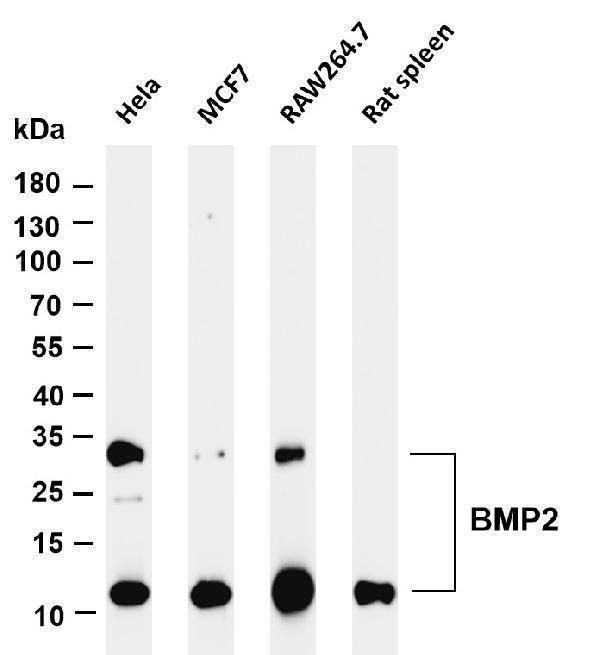 Various whole cell lysates were separated by 4-20% SDS-PAGE, and the membrane was blotted with anti-BMP2 antibody