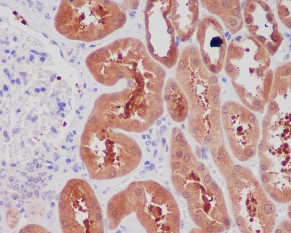 m00341 ihc