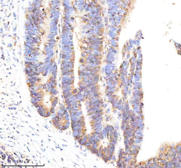 m00342 f3 primary antibodies ihc testing 2