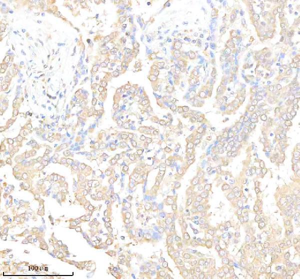 m00342 f3 primary antibodies ihc testing 3
