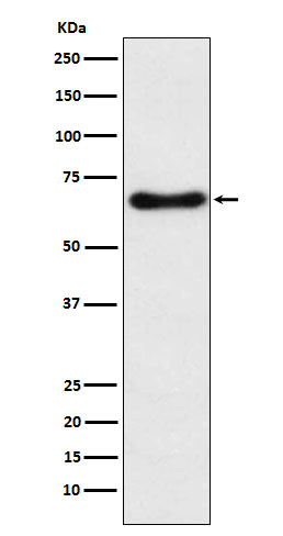 Western blot analysis of CYP24A1 expression in Human fetal liver lysate