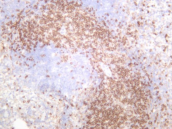Mouse spleen was stained with anti-CD4 rabbit antibody