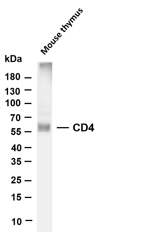 Various whole cell lysates were separated by 4-20% SDS-PAGE, and the membrane was blotted with anti-CD4 antibody