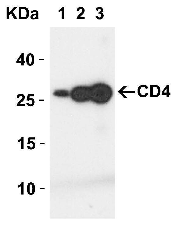 Western Blot Validation with Human Recombinant Protein
Loading: 5ng (Lane 1), 25ng (Lane 2) and 100ng (Lane 3) of human CD4 recombinant protein