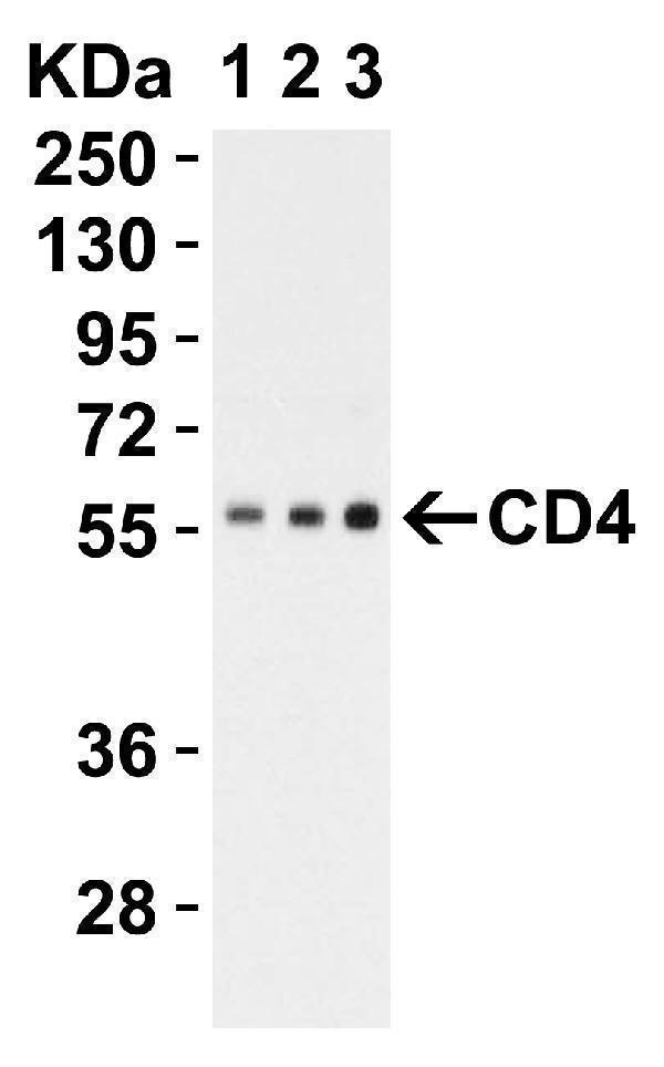 Western Blot Validation in Human Jurkat Lysate
Loading: 15 μg of lysates per lane