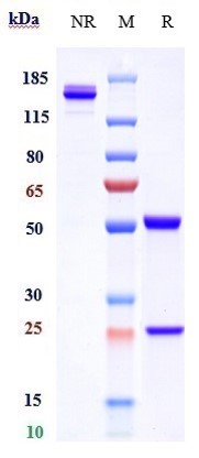 Anti-CD4 Reference Antibody (tregalizumab) on SDS-PAGE under reducing (R) condition