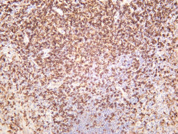 Human tonsil was stained with anti-CD4 rabbit antibody