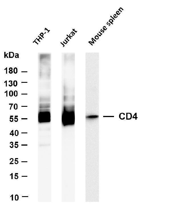 Various whole cell lysates were separated by 4-20% SDS-PAGE, and the membrane was blotted with anti-CD4 antibody