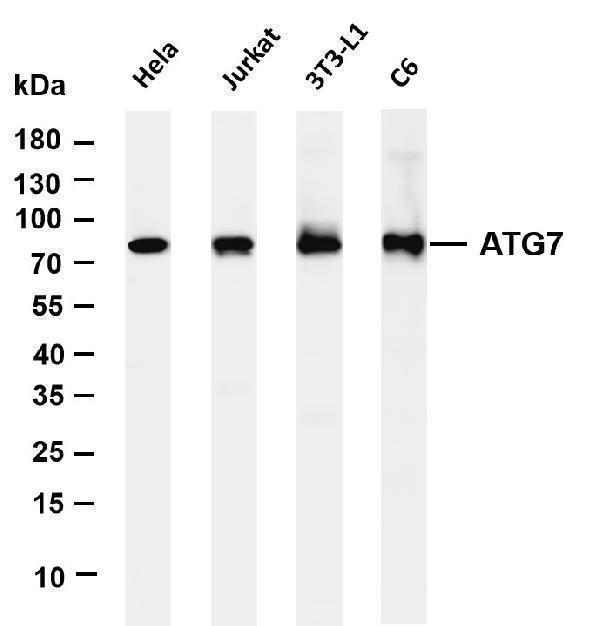 Various whole cell lysates were separated by 4-20% SDS-PAGE, and the membrane was blotted with anti- ATG7 antibody