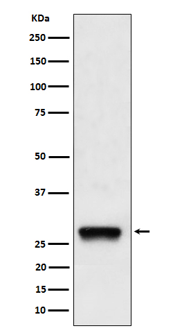 Western blot analysis of PDGF B expression in A375 cell lysate