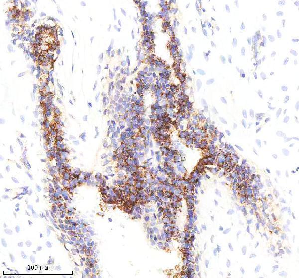  IHC analysis of SOD2 (acetyl K68) using anti-SOD2 (acetyl K68) antibody (M00349-2)