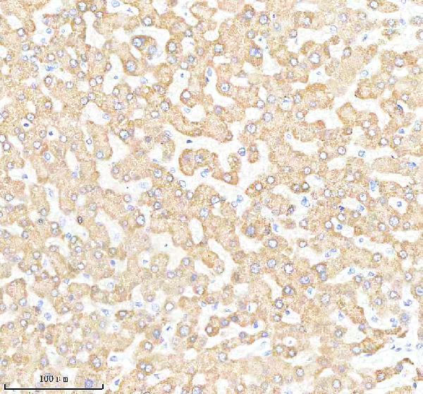  IHC analysis of SOD2 (acetyl K68) using anti-SOD2 (acetyl K68) antibody (M00349-2)