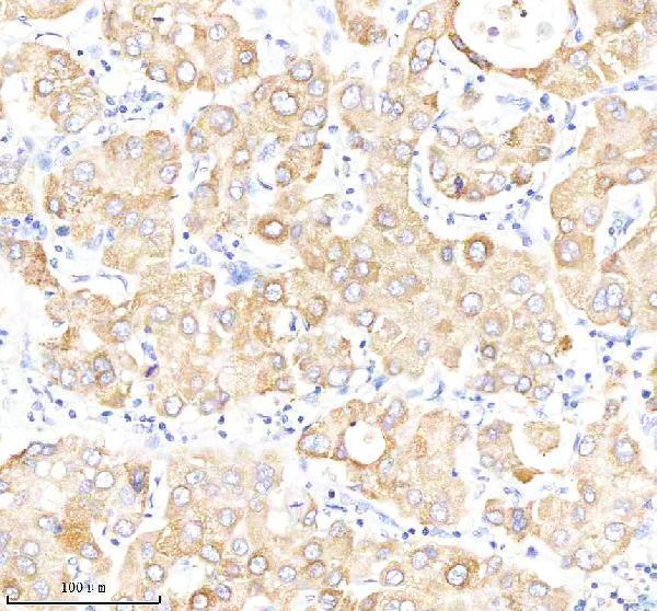 m00349 2 sod2 primary antibodies ihc testing 4