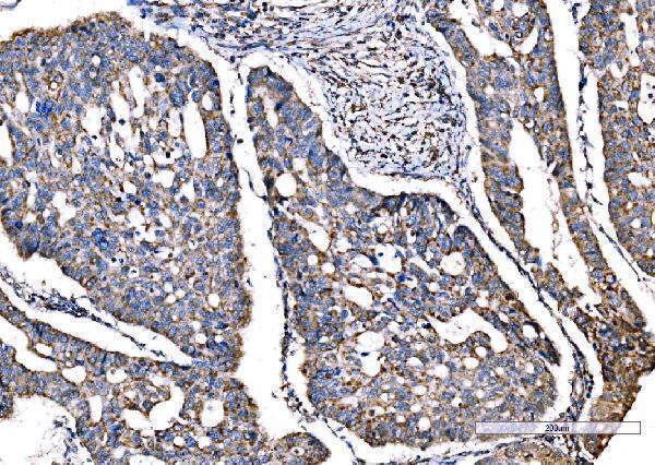  IHC analysis of SOD2 using anti-SOD2 antibody (M00349-3)