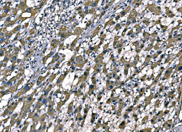  IHC analysis of SOD2 using anti-SOD2 antibody (M00349-3)