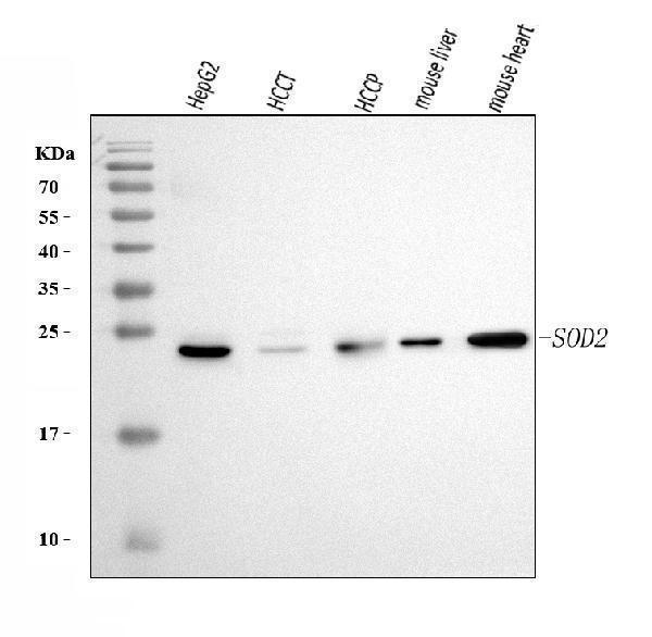  Western blot analysis of SOD2 using anti-SOD2 antibody (M00349-3)