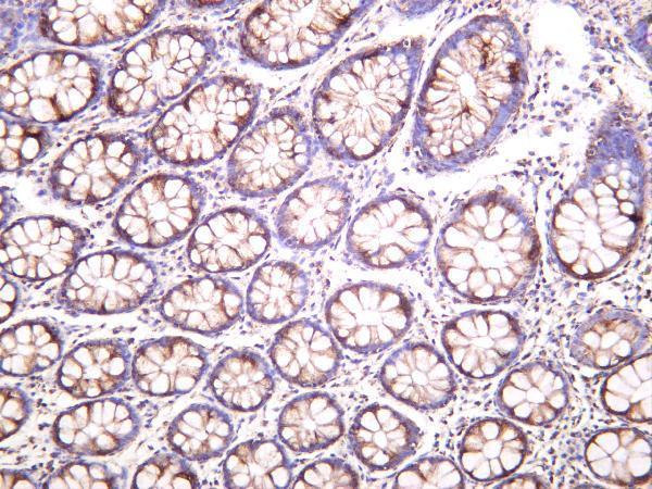 Human colon was stained with anti-SOD2 rabbit antibody