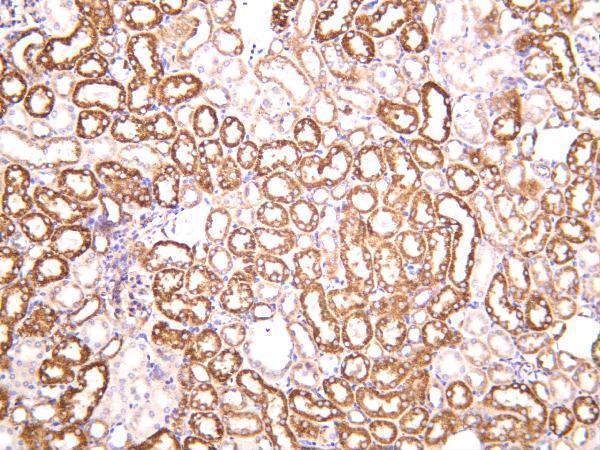 Mouse kidney was stained with anti-SOD2 rabbit antibody