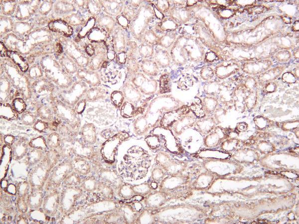 m00349 5 sod2 primary antibodies ihc testing 4