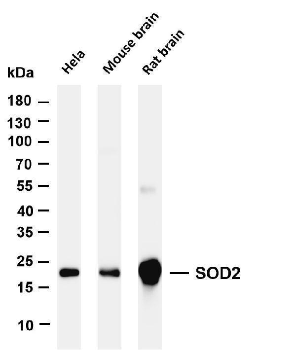 m00349 5 sod2 primary antibodies wb testing 1
