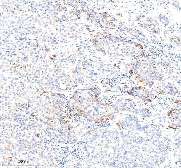 m00349 sod2 primary antibodies ihc testing 3