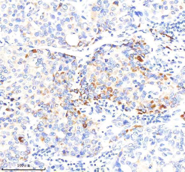 m00349 sod2 primary antibodies ihc testing 4