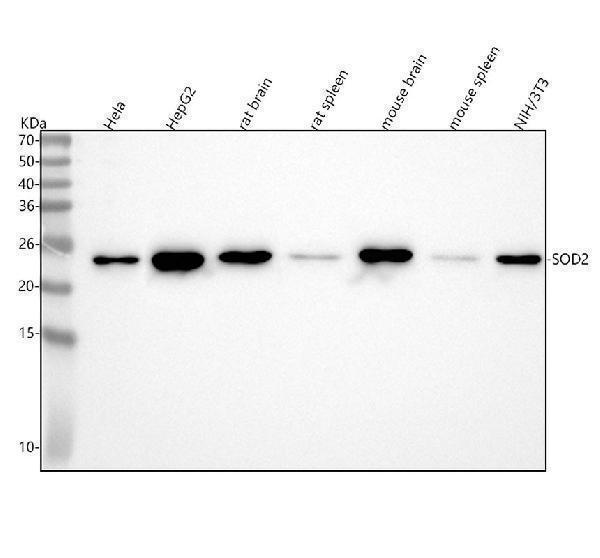  Western blot analysis of SOD2/Mnsod using anti-SOD2/Mnsod antibody (M00349)