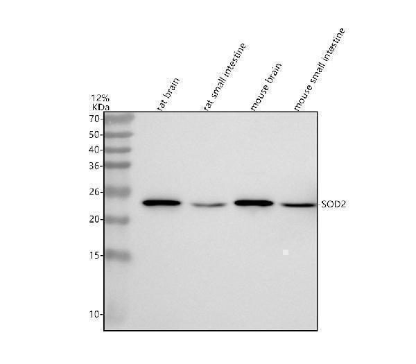  Western blot analysis of SOD2/Mnsod using anti-SOD2/Mnsod antibody (M00349)
