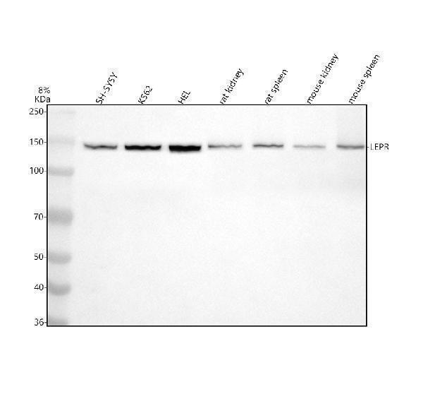  Western blot analysis of Leptin Receptor using anti-Leptin Receptor antibody (M00350)