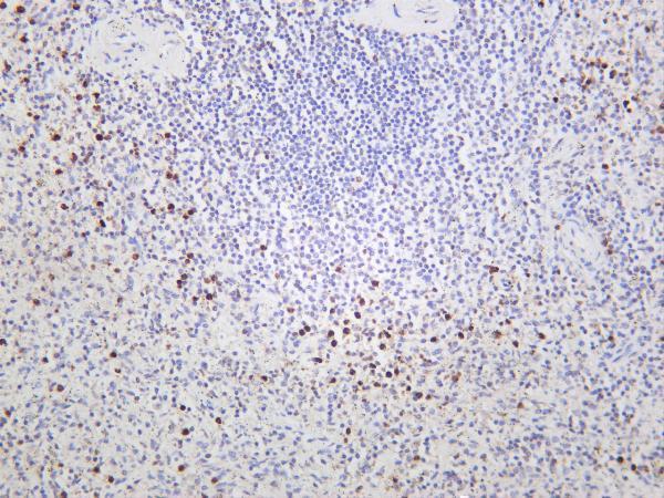 Human spleen was stained with anti-Granzyme B rabbit antibody