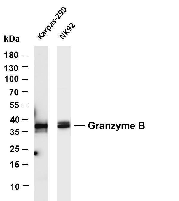 Various whole cell lysates were separated by 4-20% SDS-PAGE, and the membrane was blotted with anti-Granzyme B antibody