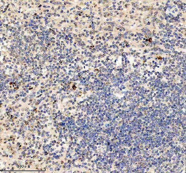 IHC analysis of Granzyme B/GZMB using anti-Granzyme B/GZMB antibody (M00353-4)