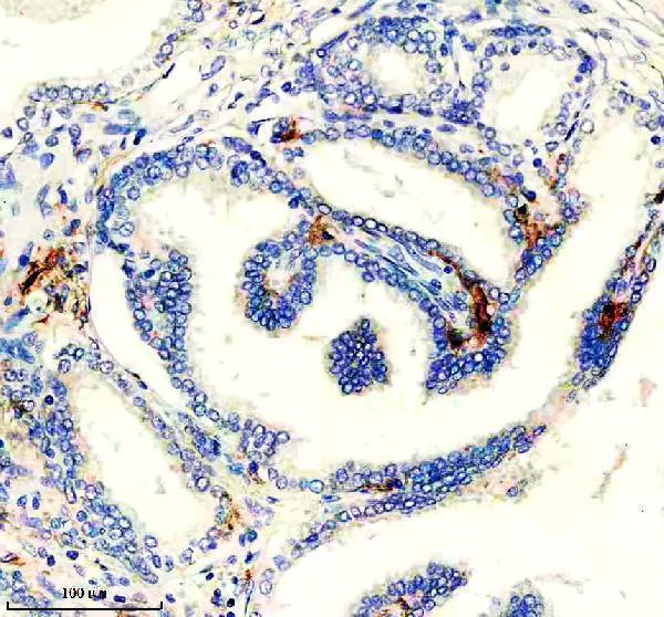 IHC analysis of ITGAX using anti-ITGAX antibody (M00357-1)
